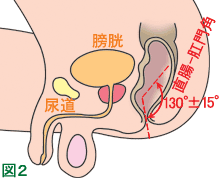 トイレで前屈している状態（男性）